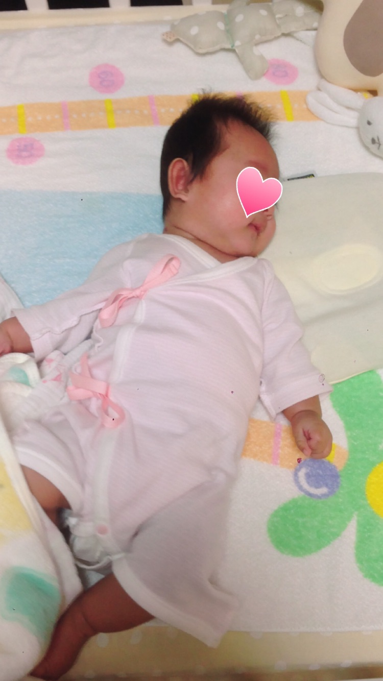 赤ちゃん 絶壁 治っ た 枕