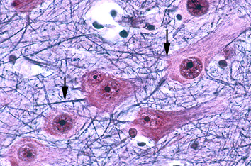 neuronbod02.jpg